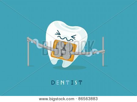 Braces tooth