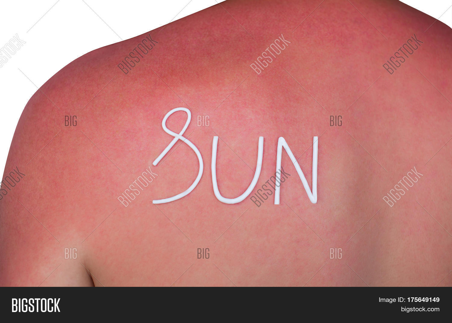 Man Reddened Itchy Image & Photo (Free Trial) Bigstock