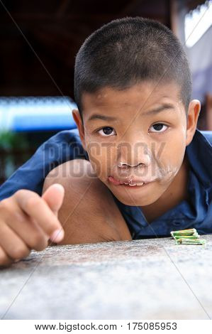 Thai Disability Boy