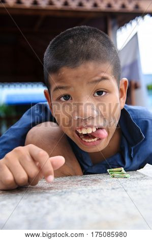 Thai Disability Boy