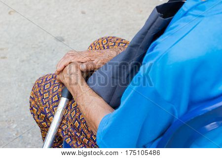 closeup hand of old asian woman suffering from leprosy amputated hand