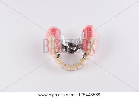 Clasp prosthesis with and attachments fixing ceramic crowns