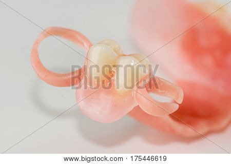 new nylon prosthesis for a patient with a partial loss of teeth