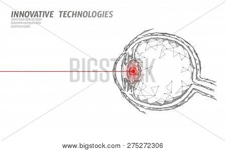 Laser Vision Correction Medicine Operation Concept. Innovation Technology Health Care. Eye 3d Low Po