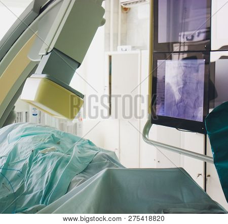 X-ray Machine In Hospital Man On The Couch.