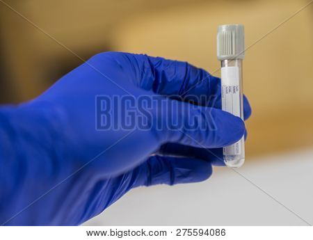 Hand Of A Doctor Holding A Bottle For Samples.