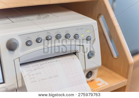 Close-up Fetal Monitor With Baby Heart Beats At Labor Room Hospital