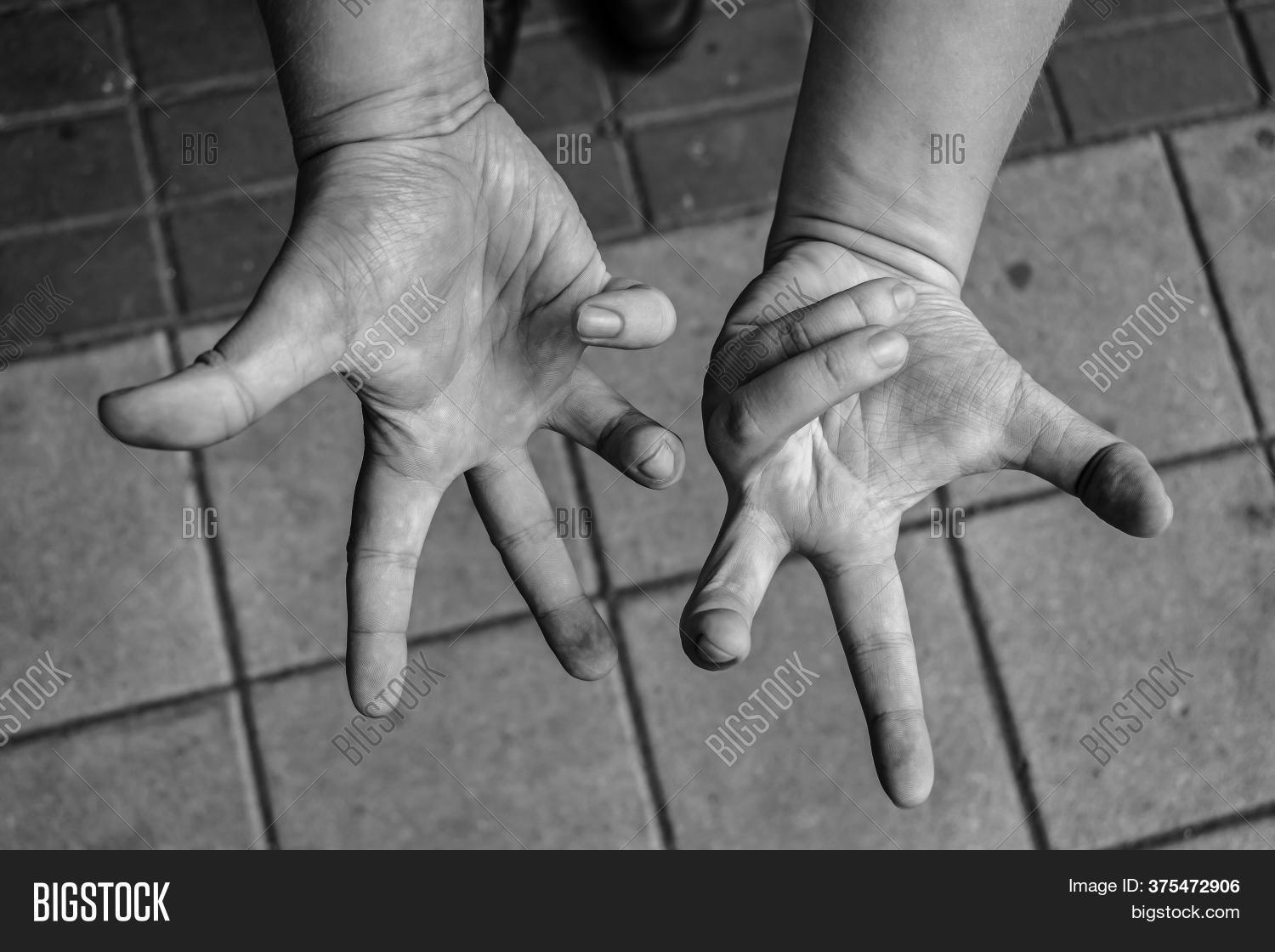 Numbness Hands Sick Image & Photo (Free Trial) Bigstock