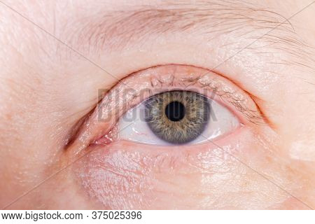Open Left Human Eye With Gray Iris With Small Amounts Of Yellow Color And Some Blood Vessels On Scle
