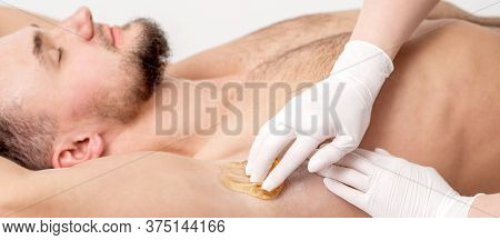 Depilation And Epilation Male Armpit With Liquid Sugar Paste. Hand Of Cosmetologist Applying Wax Pas