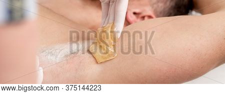 Depilation And Epilation Male Armpit With Liquid Sugar Paste. Hand Of Cosmetologist Applying Wax Pas