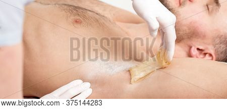 Depilation And Epilation Male Armpit With Liquid Sugar Paste. Hand Of Cosmetologist Applying Wax Pas