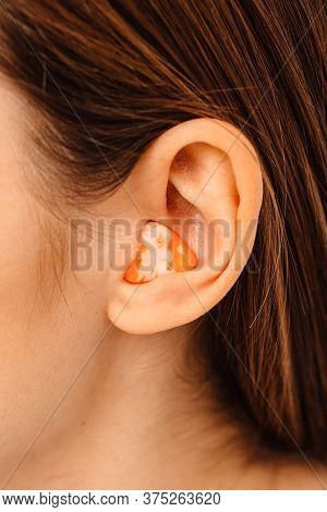 Earplugs For Noisy Places, Personally Molded Earplugs On Ear Close-up. Individual Stylish Earplugs