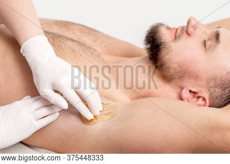 Depilation And Epilation Male Armpit With Liquid Sugar Paste. Hand Of Cosmetologist Applying Wax Pas