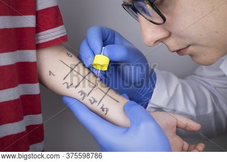 An Allergist Doctor Makes A Skin Test For Allergies. The Boy Is Being Examined In The Laboratory, Wa