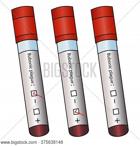 Collection Of Clinical Samples. Test Tubes With Patient Analyzes. Colored Vector Set. Diagnosis Of B