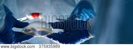 Close-up Of Plastic Surgeon Doing Implantation Procedure With Implants. Practitioner Performing Oper