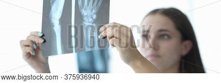 Close-up Of Female Hands Holding Skiagram. Serious Surgeon Looking Attentively On Wrist X-ray And Ma