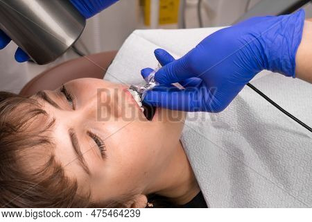 Orthodontist Scans Patient With Dental Intraoral Scanner. Prosthodontics And Stomatology Concept. De
