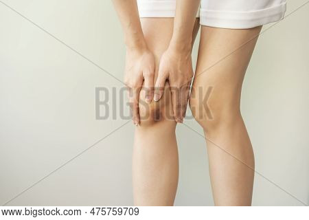 Close Up Of Stain Bruise Wound On Leg, Contusion Asian Young Woman, Girl On Joint Knee From An Accid