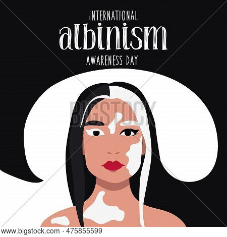 June 13 Is The International Albinism Awareness Day. A Woman With Partial Albinism With Straight Hai