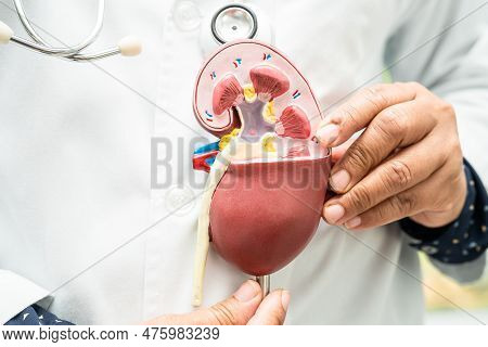 Kidney Disease, Chronic Kidney Disease Ckd, Doctor Hold Model To Study And Treat In Hospital.