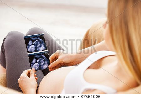 Pregnant Woman With X-ray Image.