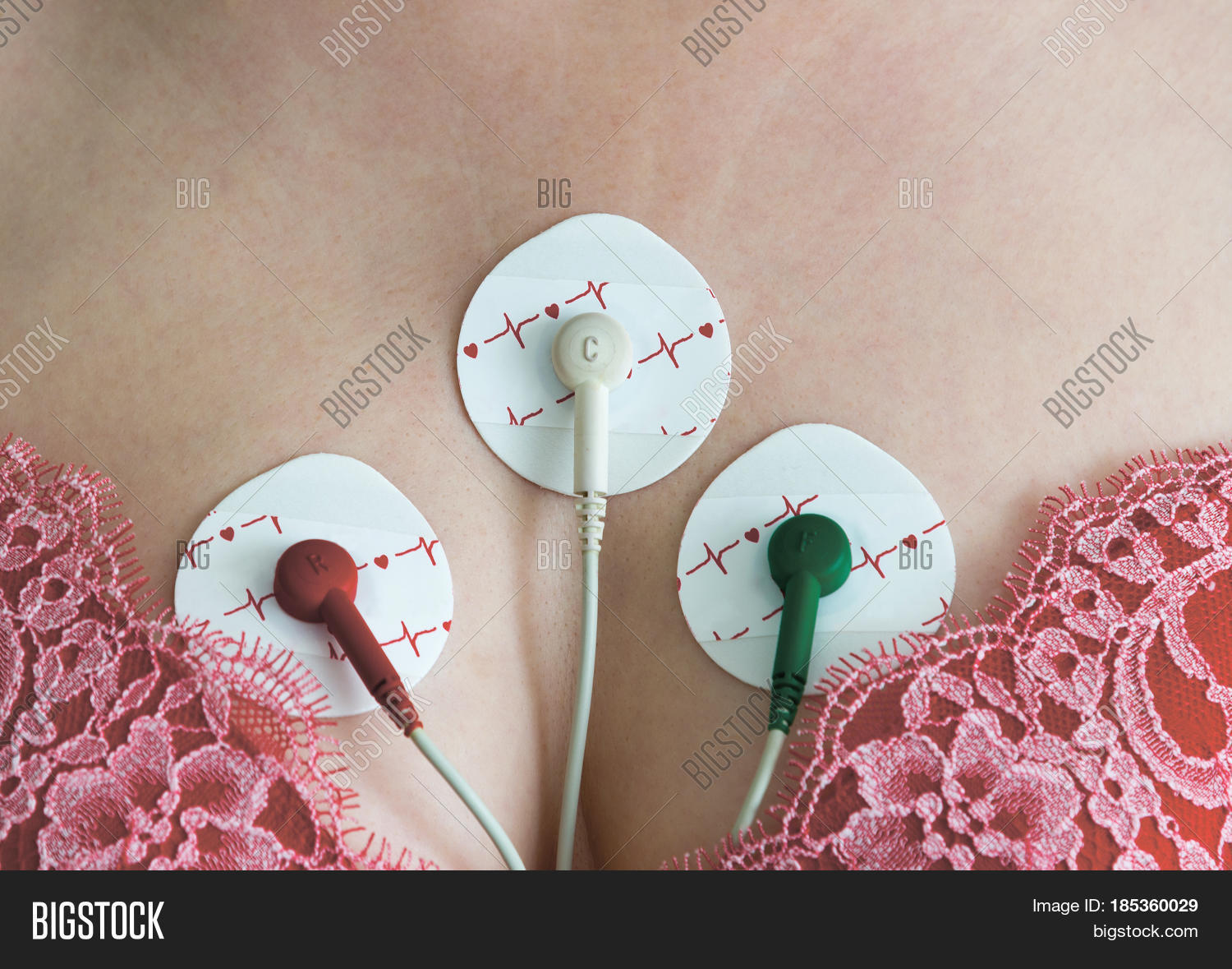 Electrodes Holter Image & Photo (Free Trial) Bigstock