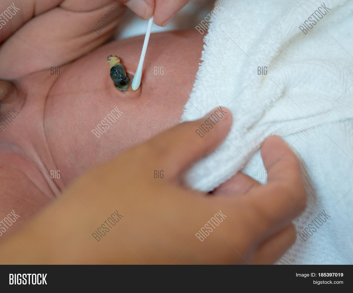 Mother Clean Umbilical Image & Photo (Free Trial) Bigstock