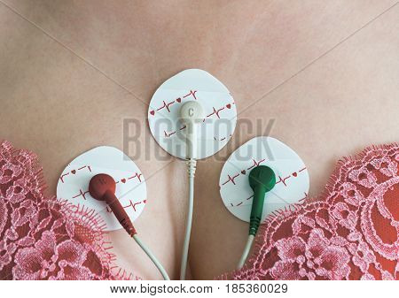 Electrodes Holter monitoring on the chest of a woman