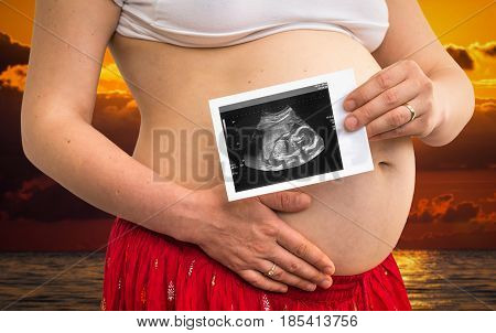 Belly Of A Pregnant Woman And Ultrasound Scan Of Baby