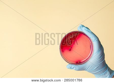Hand Holds Petri Dish With Staphylococcus Aureus Bacteria. Medical Lab Testing For Infection.bacteri
