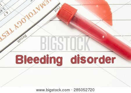 Diagnosis Bleeding Disorder. Notepad With Text Labels Bleeding Disorder, Laboratory Test Tubes For T