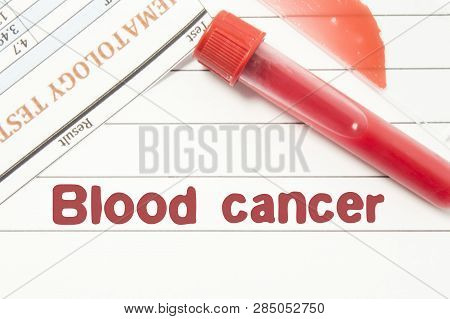 Diagnosis Blood Cancer. Notepad With Text Labels Blood Cancer, Laboratory Test Tubes For The Blood, 