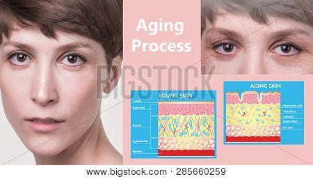 The Younger Skin And Aging Skin. Elastin And Collagen. A Diagram Of Young And Old Face Showing The D