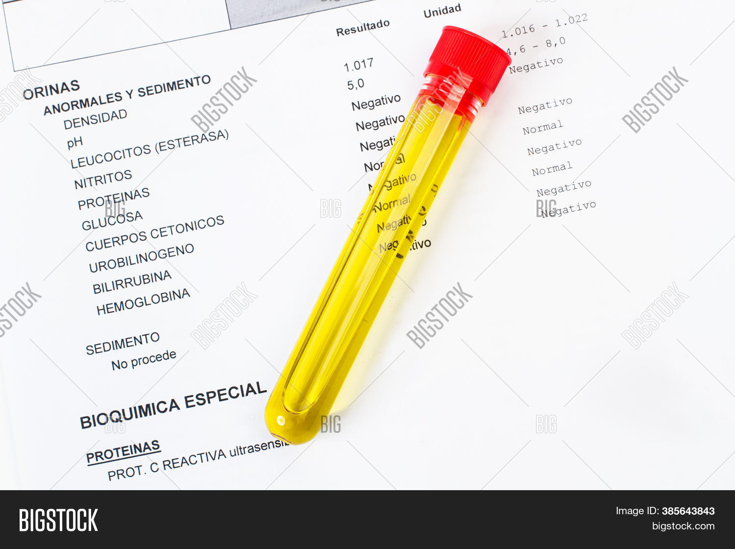 Test Tube Urine Image & Photo (Free Trial) Bigstock