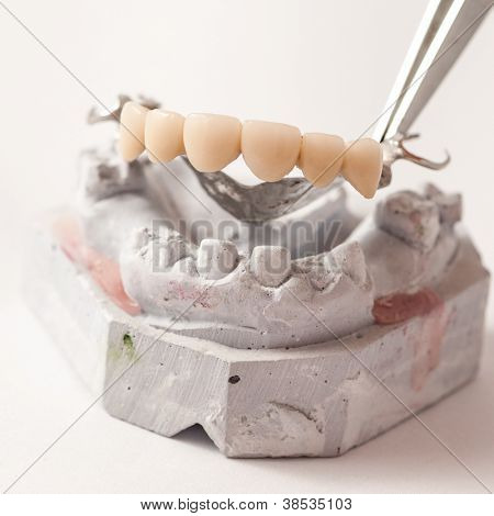 Prothetischen Dentallabor, technische Aufnahmen