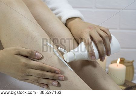 A Woman Applies A Moisturizer To The Skin Of Her Legs. Problem Skin, Strawberry Legs, Chicken Skin, 