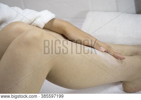 A Woman Applies A Moisturizer To The Skin Of Her Legs. Problem Skin, Strawberry Legs, Chicken Skin, 