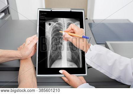 Pulmonologist Showing An Old Patient An X-ray Image Of Her Lungs. Prevention And Treatment Of Lung D