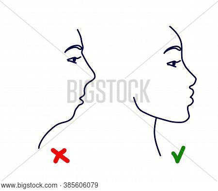 Silhouette Of A Female Head On A White Background. Facial Correction And Posture. Vector Illustratio