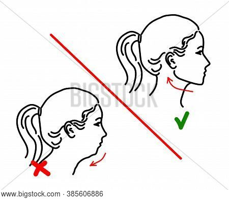 Silhouette Of A Female Face On A White Background. Correction Of The Lower Jaw. Vector Illustration.
