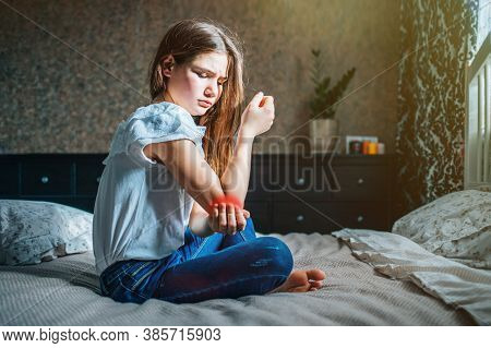 Young Brunette Girl Sits On A Bed In Her Room, Holds A Sore Elbow With Her Hand