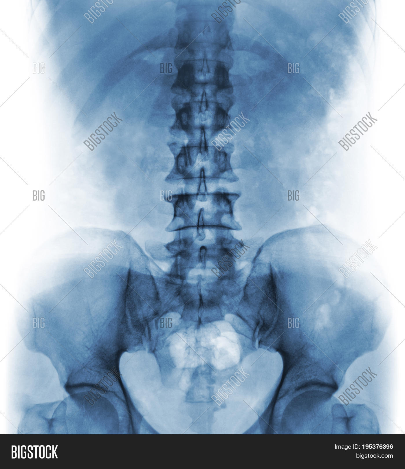Film X-ray Normal Image & Photo (Free Trial) | Bigstock