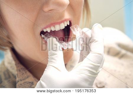 Woman Getting Dental Mold Made
