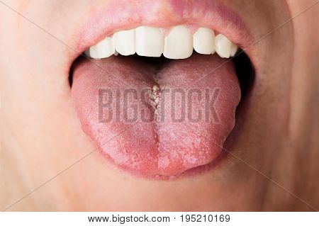 Closeup photo of man showing his tongue