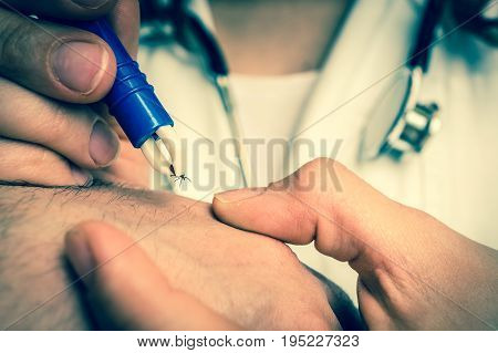 Doctor Removing A Tick With Tweezers From Hand Of Patient