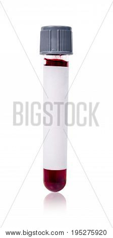 Grey vacuum blood tube test with sample blood for Medical laboratory isolated on white background clipping path.