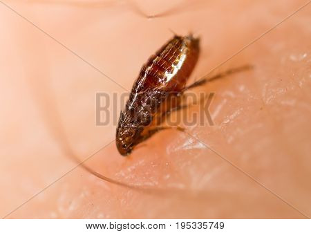 Flea on a human skin. Super macro