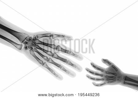 Adult help child . adult stretch out hand for grasp child hand . ( Connotation : Help orphan Medical aid )